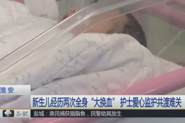 新生兒患上溶血癥，經歷了兩次全身“大換血”，溶血癥的癥狀(1)