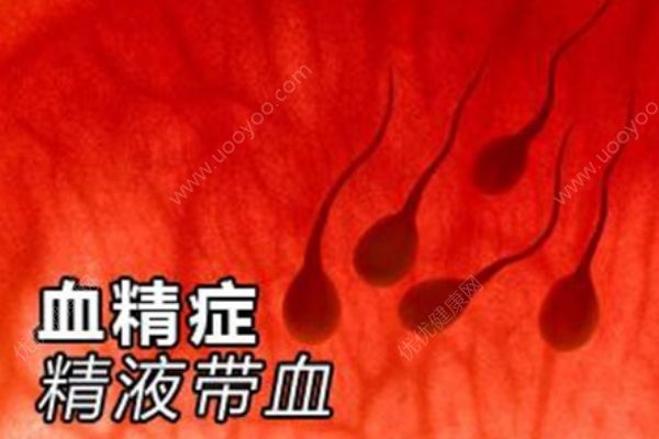 男人得了血精癥怎么辦？推薦四大血精癥的食療方！(1)