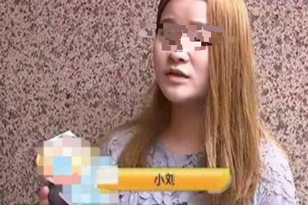 女子花5300元割雙眼皮，3年后想退款：左眼是四眼皮(2)