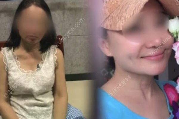 欠債3000萬(wàn)整容成“少女”，玩游艇開豪車卻哭窮不還債(2)