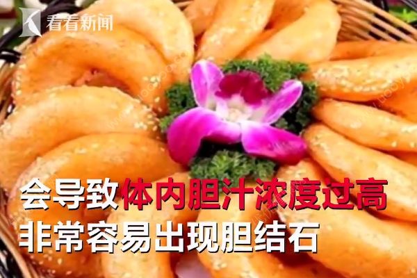 愛吃油炸長468顆結(jié)石，油炸食品的危害有哪些？(3)