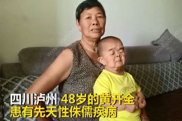 48歲兒子僅76厘米3歲智商永遠(yuǎn)