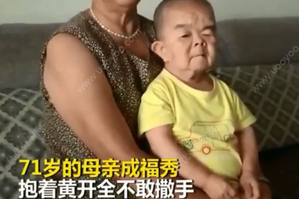 48歲兒子僅76厘米3歲智商永遠(yuǎn)