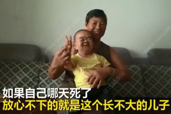 48歲兒子僅76厘米3歲智商永遠(yuǎn)