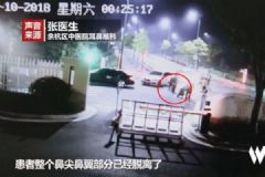 男子圍觀情侶吵架，被咬掉鼻尖，情侶間如何避免吵架？[多圖]