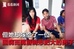 美女離婚改嫁畸形嘴丑男，前夫指責(zé)“她一定是為了錢”[多圖]