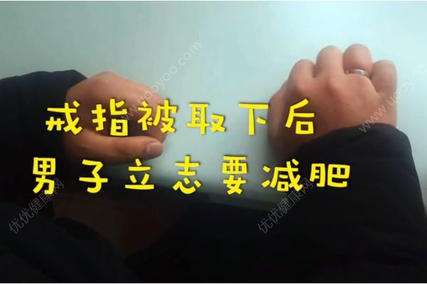 男子春節(jié)吃的太胖，戒指卡手上取不下來(lái)(4)