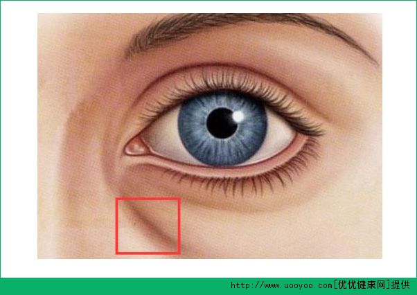 臥蠶和黑眼圈有什么區(qū)別？臥蠶和眼袋有什么區(qū)別？(4)