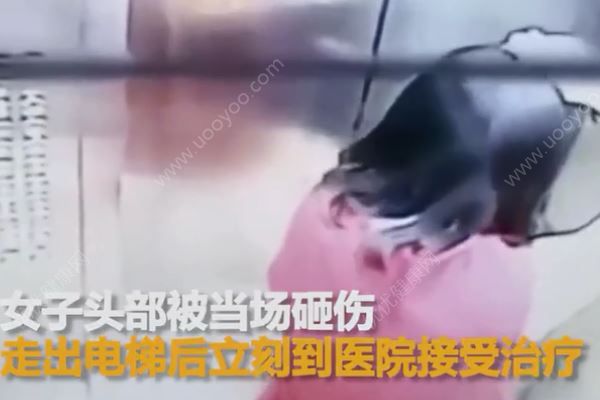 電梯吊頂突然墜落，女子慘被砸破頭，乘坐電梯注意事項(xiàng)(2)