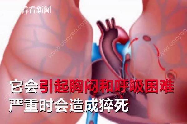 男子打麻將久坐不起險猝死，打麻將猝死是什么原因？(3)