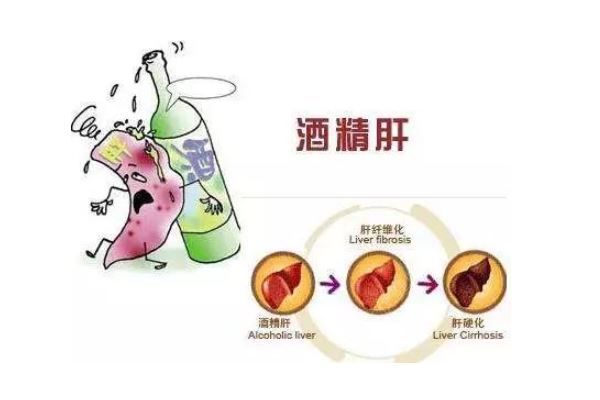 每天半斤白酒，30多歲小伙竟變成“女兒身”，長(zhǎng)期飲酒的危害(3)