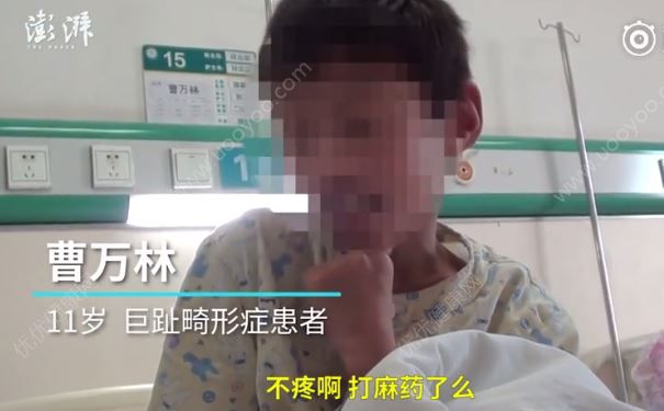 媒體傳11歲大腳娃手術(shù)為省錢不打二百元麻藥，被批真外行(3)