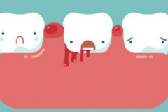 牙齦出血的治療方法有哪些？牙齦出血的注意事項(xiàng)有哪些？[圖]