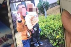 10歲男孩沖進火場救4歲弟弟全身被燒傷，被燒傷后怎么辦？[多圖]