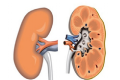腎炎該怎么治療最好？腎炎有傳染性嗎？[圖]
