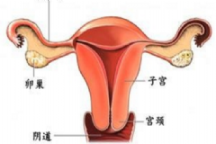 附件炎如何根治？附件炎是怎么引起的？[圖]