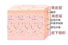 不同程度的凍瘡 凍瘡的病癥告訴你你哪里凍傷[多圖]