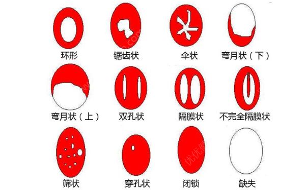 女人處女膜長在哪兒？女人處女膜是在什么位置？(1)