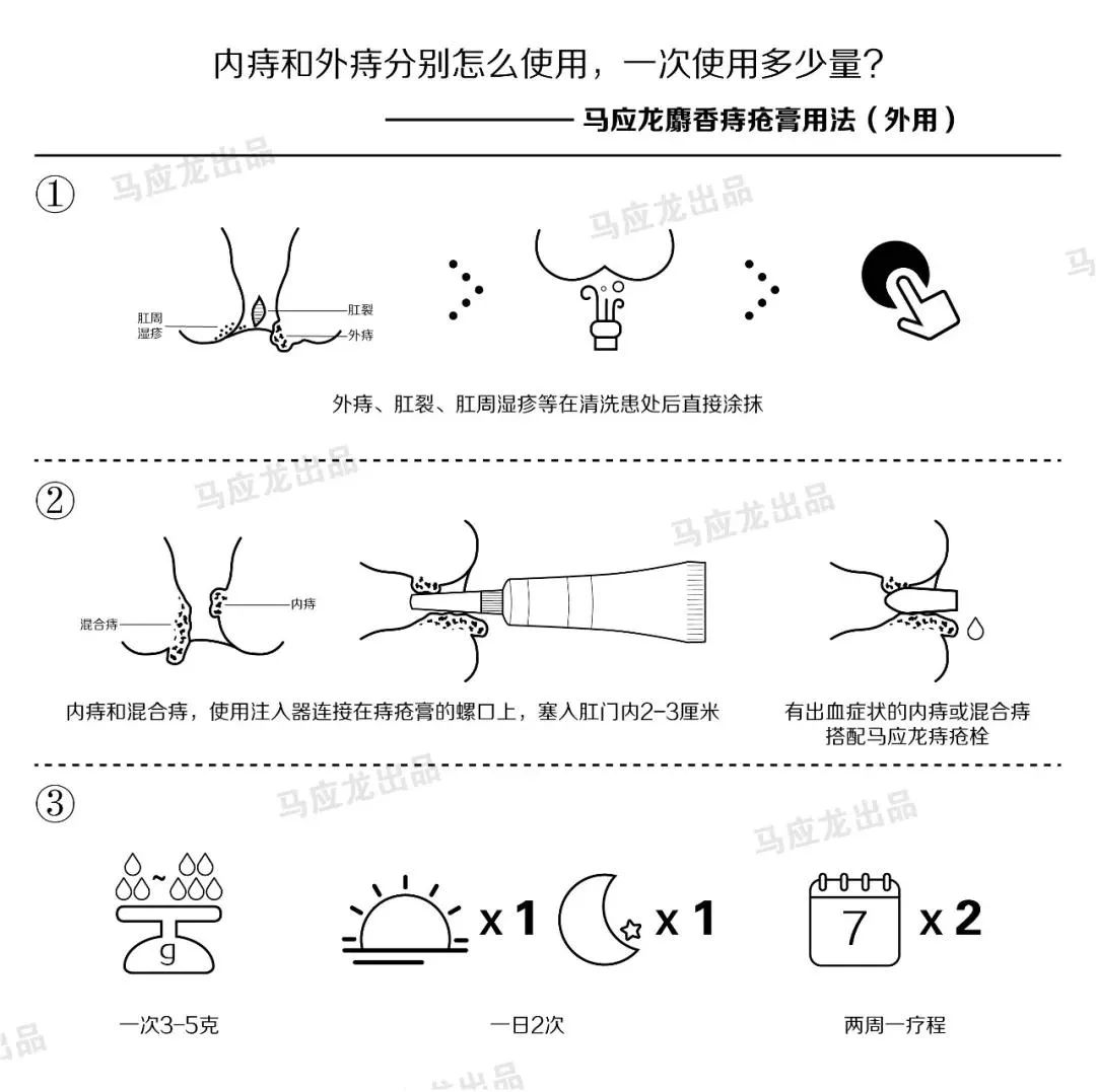 武漢馬應龍肛腸醫(yī)院正規(guī)靠譜 專業(yè)高效