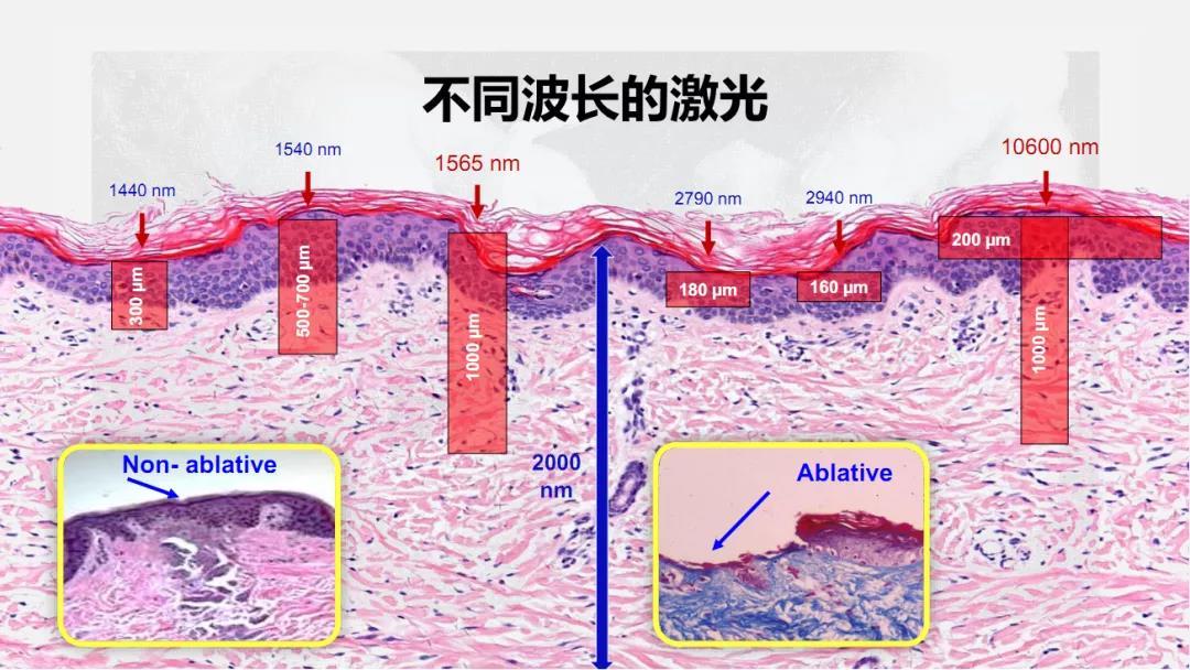 皮膚微創(chuàng)整形術(shù)后注意事項(xiàng)有哪些？廣州伊站醫(yī)療美容中心好嗎