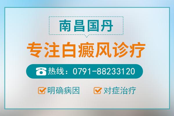 南昌國丹醫(yī)院怎么樣？治療白癜風(fēng)正常大概花多少錢？