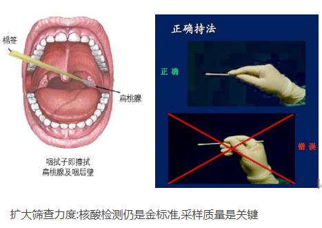 核酸檢測新冠病毒的常用手段：口腔拭子、鼻腔拭子檢測圖解