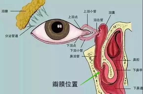 合肥愛爾眼科：什么是淚道疾?。咳绾晤A(yù)防