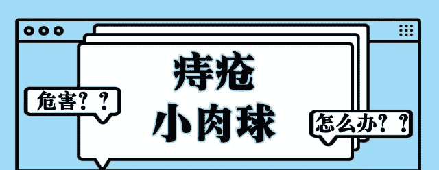 天津歐亞肛腸醫(yī)院解答：外痔瘡肉球摸著別扭，發(fā)作起來(lái)疼痛，怎么消除？