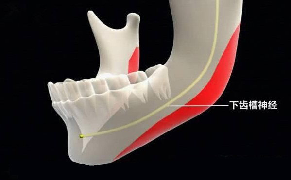 聯(lián)合麗格第一醫(yī)院何照華教授：下頜角手術(shù)會(huì)不會(huì)損傷神經(jīng)線？