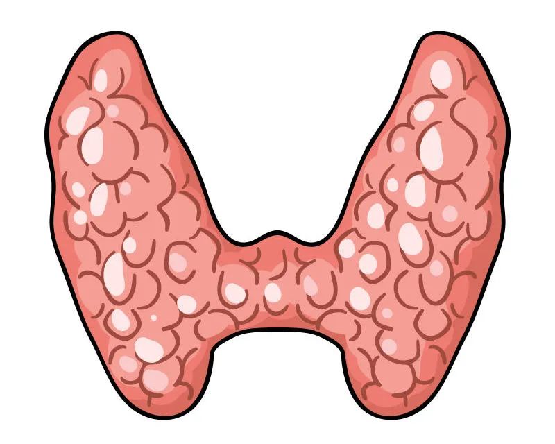 當(dāng)心！成都民生耳鼻喉醫(yī)院：身體有這幾種表現(xiàn)，說明你的甲狀腺出了問題！