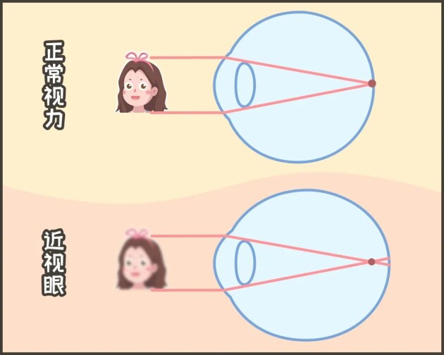 合肥愛(ài)爾：「我可以治好你的近視，但不改變度數(shù)?！股叮?></a><p class=