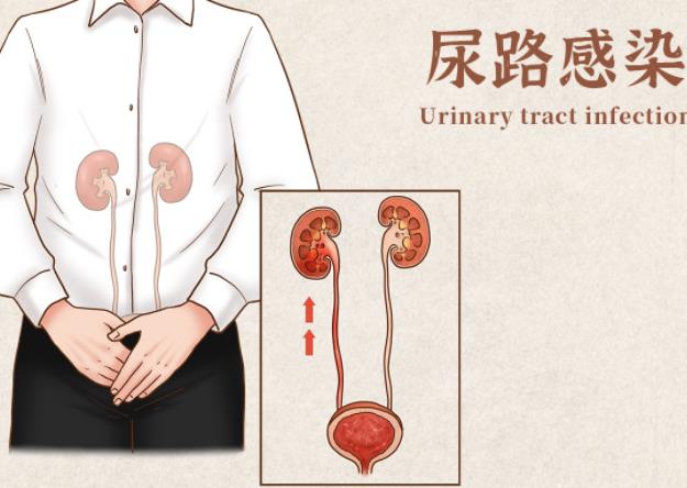 尿路感染是怎么引起的 尿路感染有什么癥狀