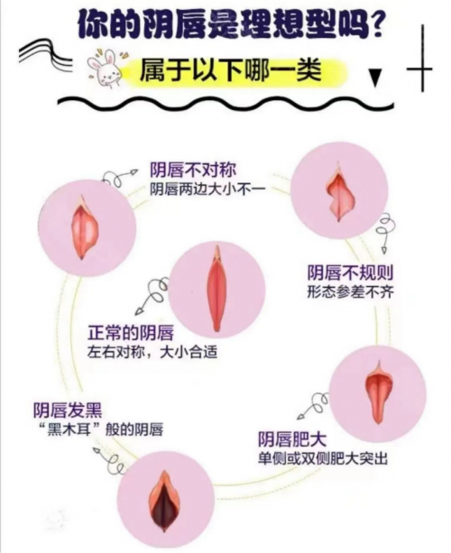 昆明做陰唇整形會留疤嗎？多久能恢復呢？