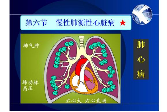 冠心病是心臟病嗎？什么是肺源性心臟??？