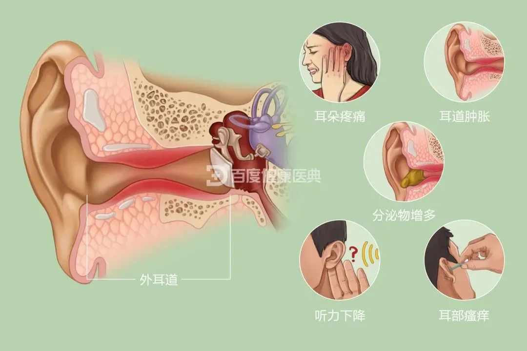 兒童患”流感“為什么會耳朵疼？成都民生耳鼻喉醫(yī)院專家解答原因 國家三級醫(yī)院