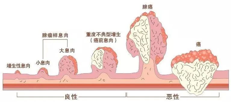  揚(yáng)州妙手醫(yī)院睡眠式無痛胃腸鏡檢查，不僅準(zhǔn)確，而且“快速”