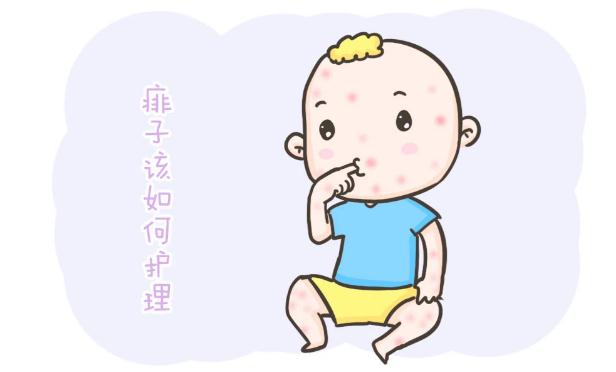 怎么做可以預(yù)防痱子？寶寶長(zhǎng)痱子怎么辦？