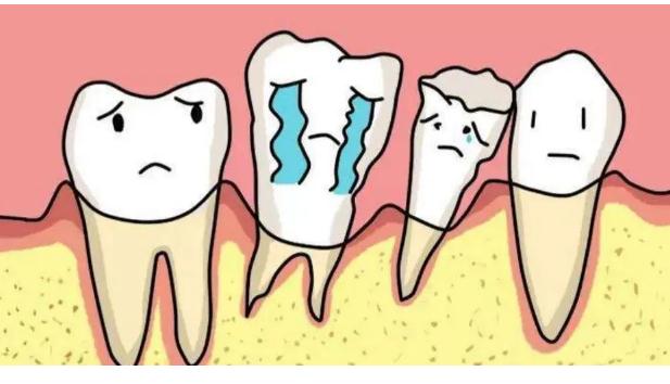 哪些牙齒需要拔掉？含氟牙膏對(duì)牙齒的作用？