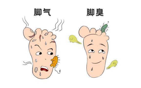 小孩得腳氣了應(yīng)該怎么辦？襪子會(huì)傳染腳氣嗎？