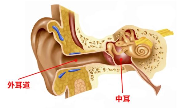 中耳炎和外耳道炎的區(qū)別？中耳炎和腮腺炎的區(qū)別？