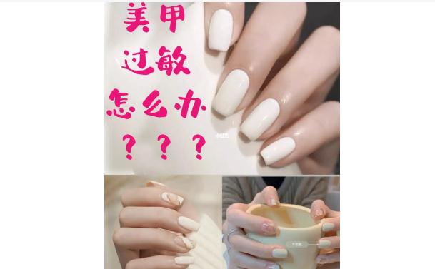 涂指甲油會(huì)過(guò)敏嗎？指甲油會(huì)導(dǎo)致灰指甲嗎？