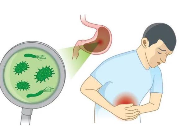 幽門(mén)螺桿菌高溫能殺死嗎 幽門(mén)螺桿菌能存活多久