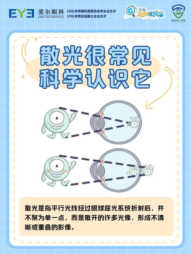 合肥愛(ài)爾眼科：孩子散光多少度，需要配眼鏡？