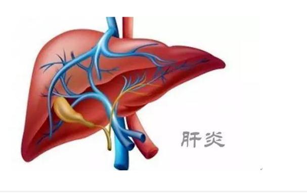 乙肝疫苗可以預(yù)防肝癌嗎？肝癌是怎么造成的呢？