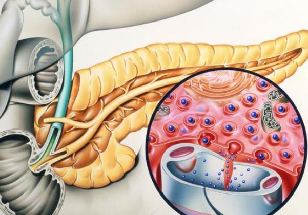 胰腺癌到底有多可怕？ 哪些人容易得胰腺癌？