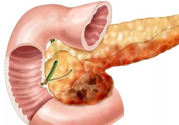 胰腺炎為什么不能喝水？狗狗胰腺炎能治好嗎？