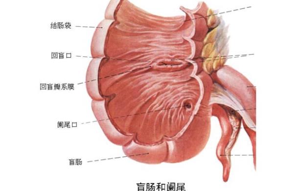 急性闌尾炎化膿嚴(yán)重嗎 闌尾炎的體征有哪些