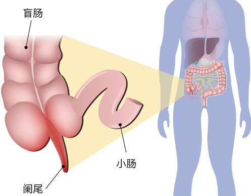 慢性闌尾炎b超能看到嗎 慢性闌尾炎檢查什么項目