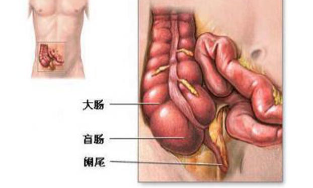 闌尾炎手術后能跑步嗎 闌尾炎手術后怎么養(yǎng)護