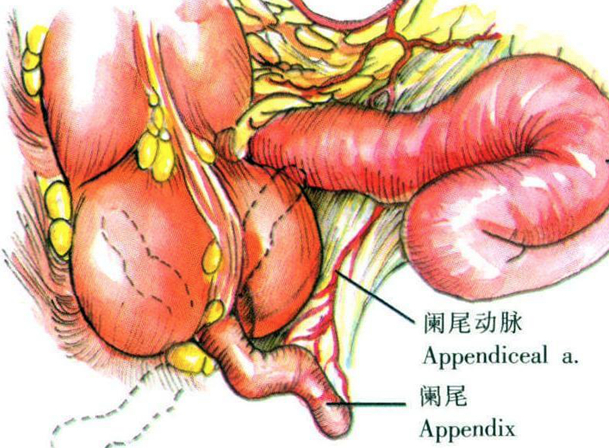 闌尾炎要做手術(shù)嗎 闌尾炎手術(shù)并發(fā)癥有哪些